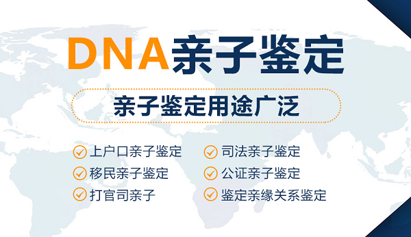 重庆司法DNA鉴定出结果要多久,重庆司法亲子鉴定哪里能做